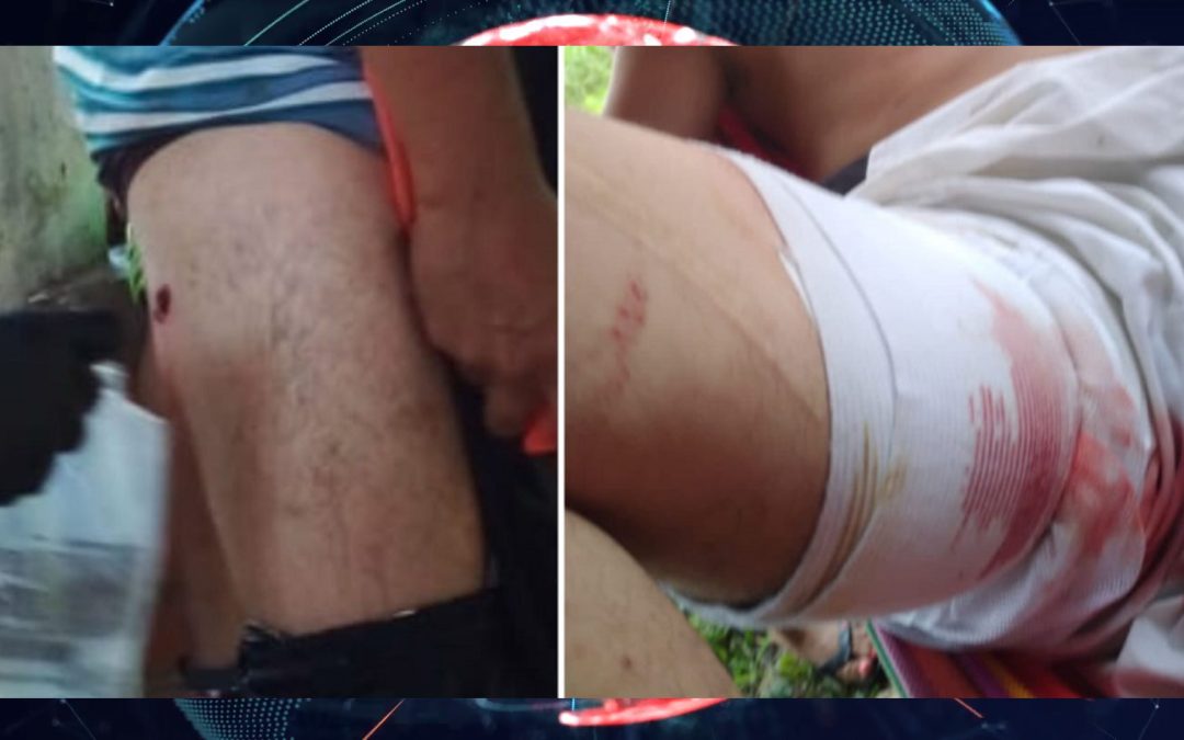 Su tío le disparó en una pierna por llevarse un electrodoméstico en Rionegro