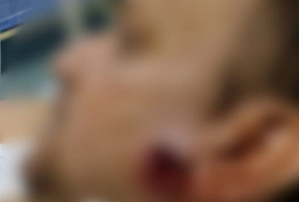 Detalles | Hieren a escolta en Barrancabermeja