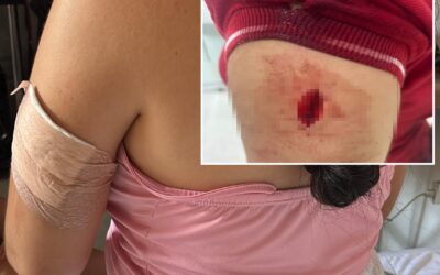 Trabajadora de tienda D1 fue atacada y herida con arma blanca en Cúcuta