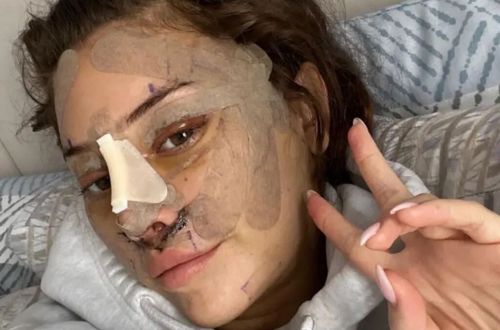¿Un “lifting” a los 28? Jóvenes recurren cada vez más a la cirugía plástica facial