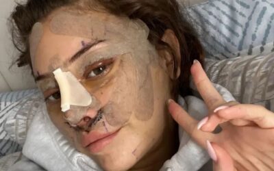 ¿Un “lifting” a los 28? Jóvenes recurren cada vez más a la cirugía plástica facial