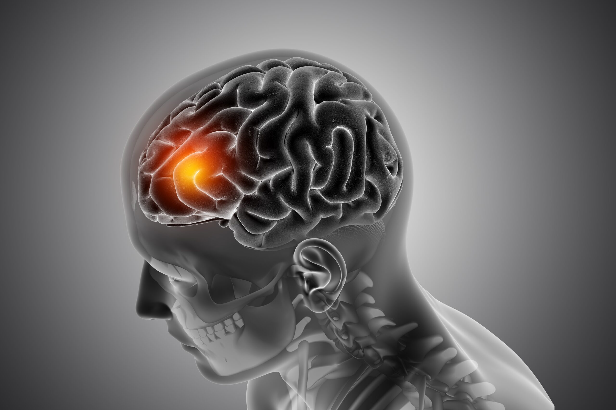 cerebro