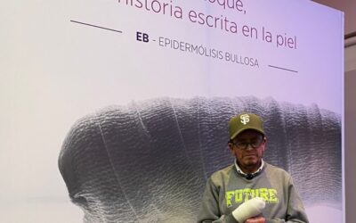 Diagnóstico oportuno, clave para pacientes con Epidermólisis Bullosa