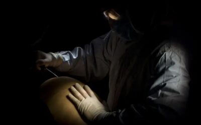 Falleció en Medellín mujer que se sometió a varias cirugías estéticas