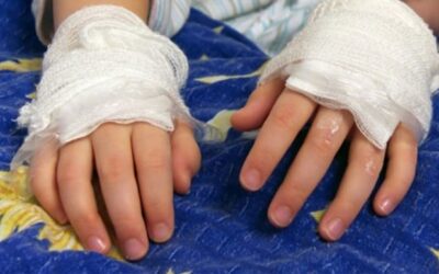 Grave incidente con gasolina dejó un niño muerto en Medellín