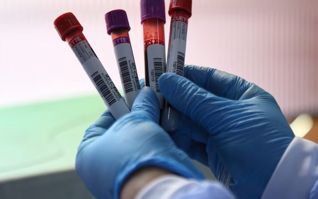 ¿Qué es la hemofilia? La enfermedad detrás del caso de Kevin Acosta