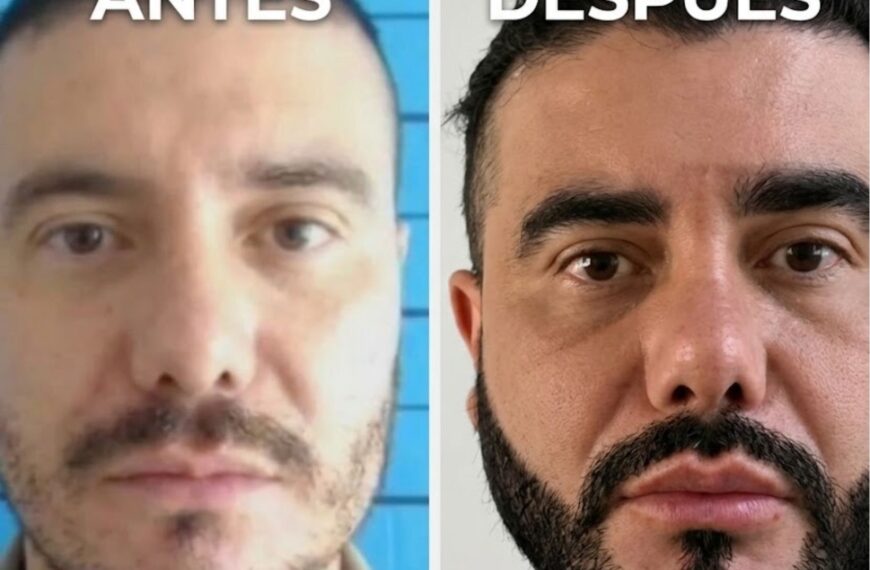 Polémica por autorización de cirugías estéticas dentro la cárcel de La Dorada para alias «Pichi»