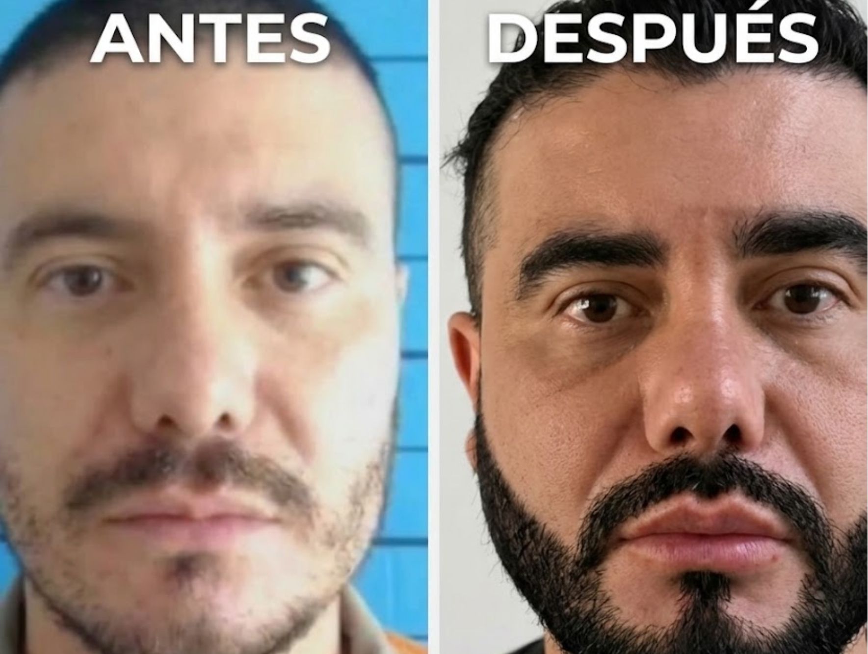 pichi nuevo